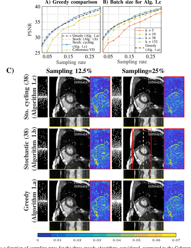 Figure 1 for Scalable Learning-Based Sampling Optimization for Compressive Dynamic MRI