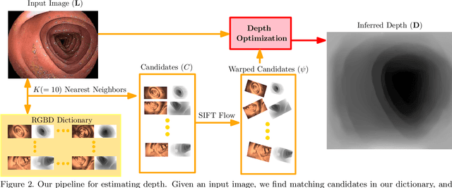 Figure 3 for Depth Reconstruction and Computer-Aided Polyp Detection in Optical Colonoscopy Video Frames