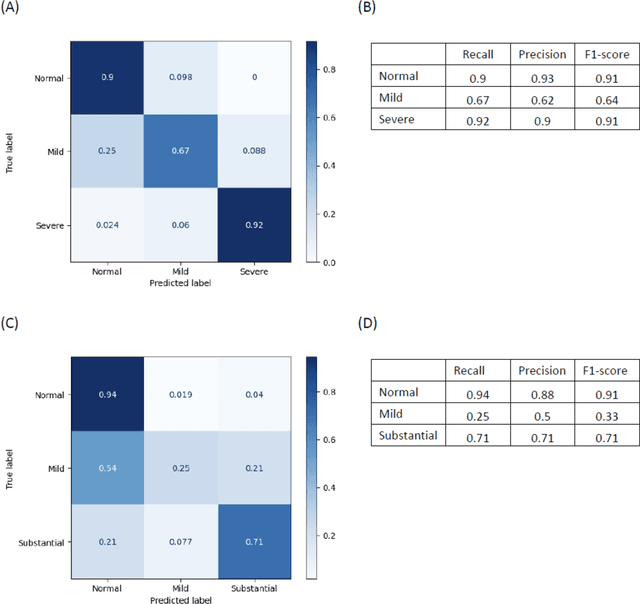 Figure 3 for Revealing unforeseen diagnostic image features with deep learning by detecting cardiovascular diseases from apical four-chamber ultrasounds