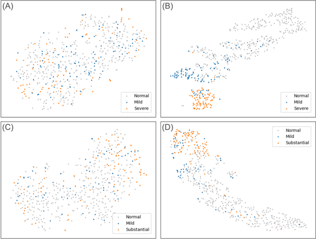 Figure 4 for Revealing unforeseen diagnostic image features with deep learning by detecting cardiovascular diseases from apical four-chamber ultrasounds