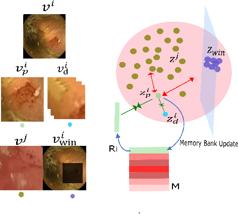 Figure 1 for From Labels to Priors in Capsule Endoscopy: A Prior Guided Approach for Improving Generalization with Few Labels