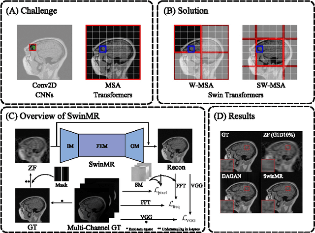 Figure 1 for Swin Transformer for Fast MRI