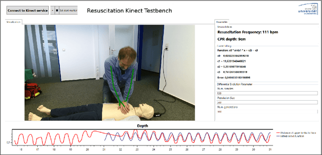 Figure 3 for Cardiopulmonary Resuscitation Quality Parameters from Motion Capture Data using Differential Evolution Fitting of Sinusoids