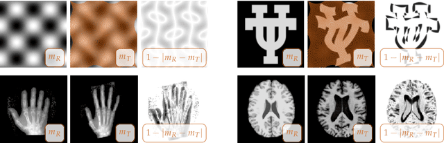Figure 2 for An inexact Newton-Krylov algorithm for constrained diffeomorphic image registration