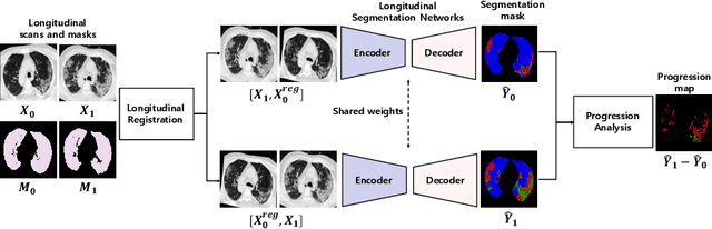 Figure 1 for Longitudinal Quantitative Assessment of COVID-19 Infection Progression from Chest CTs