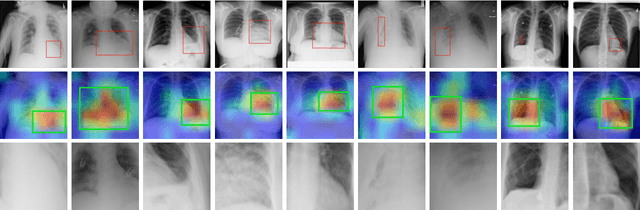 Figure 3 for Diagnose like a Radiologist: Attention Guided Convolutional Neural Network for Thorax Disease Classification