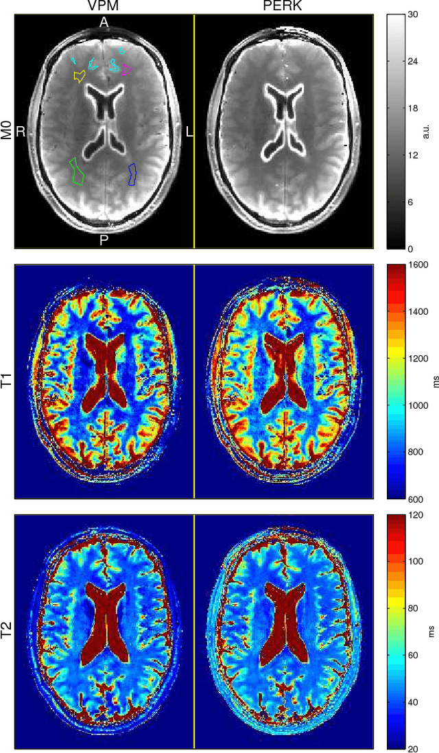Figure 2 for Dictionary-Free MRI PERK: Parameter Estimation via Regression with Kernels