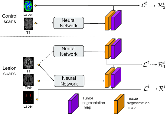 Figure 4 for Learning joint lesion and tissue segmentation from task-specific hetero-modal datasets