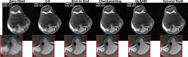 Figure 3 for GLEAM: Greedy Learning for Large-Scale Accelerated MRI Reconstruction