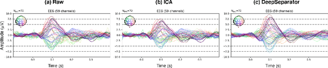Figure 3 for Embedding Decomposition for Artifacts Removal in EEG Signals
