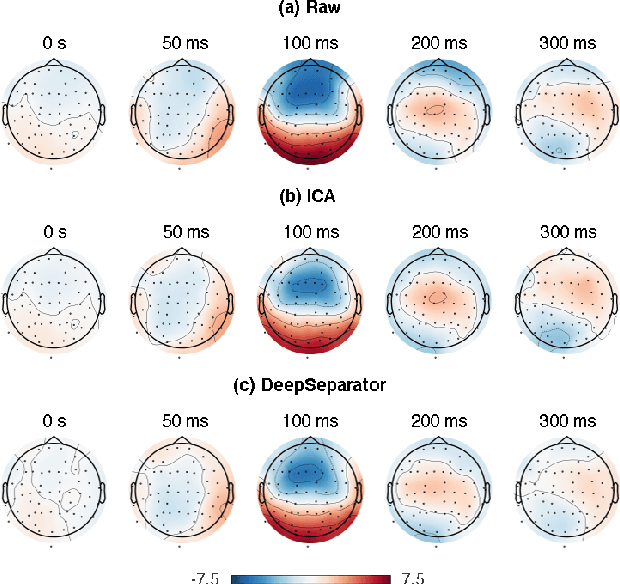 Figure 4 for Embedding Decomposition for Artifacts Removal in EEG Signals