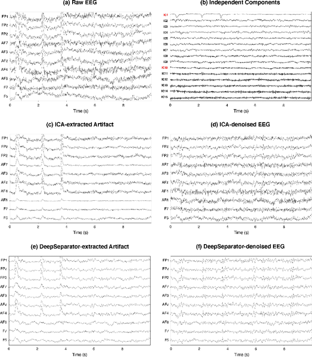 Figure 2 for Embedding Decomposition for Artifacts Removal in EEG Signals