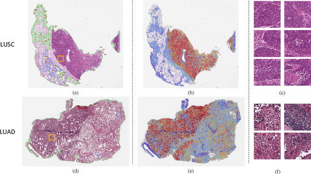 Figure 4 for Multiplex-detection Based Multiple Instance Learning Network for Whole Slide Image Classification