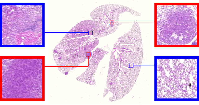 Figure 1 for Lung Cancer Lesion Detection in Histopathology Images Using Graph-Based Sparse PCA Network