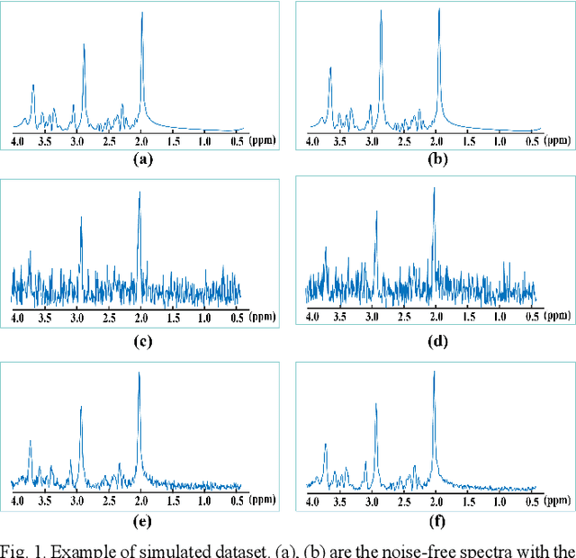 Figure 1 for Denoising Single Voxel Magnetic Resonance Spectroscopy with Deep Learning on Repeatedly Sampled In Vivo Data