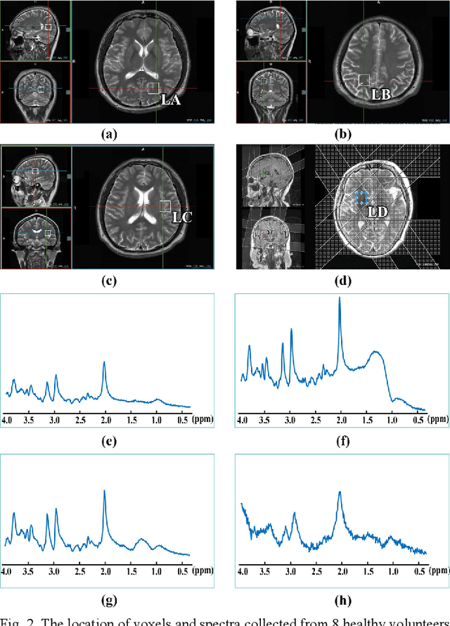 Figure 2 for Denoising Single Voxel Magnetic Resonance Spectroscopy with Deep Learning on Repeatedly Sampled In Vivo Data