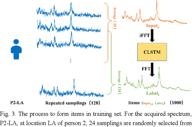 Figure 3 for Denoising Single Voxel Magnetic Resonance Spectroscopy with Deep Learning on Repeatedly Sampled In Vivo Data