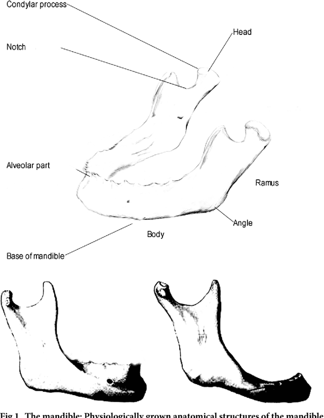 Figure 1 for Clinical evaluation of semi-automatic opensource algorithmic software segmentation of the mandibular bone: Practical feasibility and assessment of a new course of action