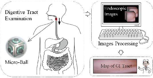 Figure 1 for 2D Reconstruction of Small Intestine's Interior Wall