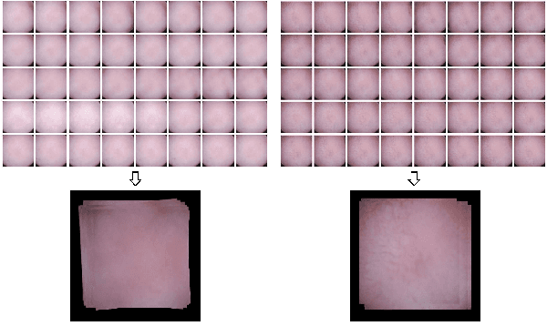 Figure 4 for 2D Reconstruction of Small Intestine's Interior Wall