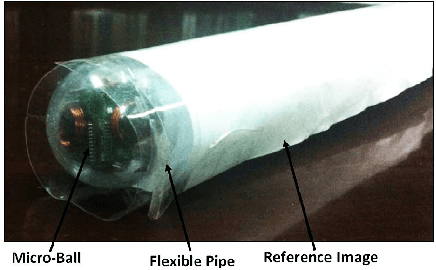 Figure 2 for 2D Reconstruction of Small Intestine's Interior Wall