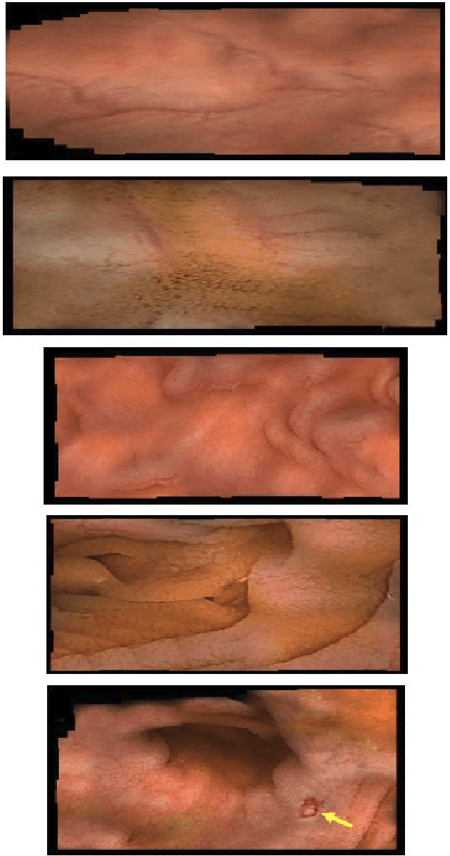 Figure 3 for 2D Reconstruction of Small Intestine's Interior Wall