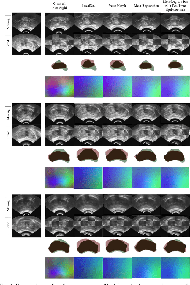 Figure 4 for Meta-Registration: Learning Test-Time Optimization for Single-Pair Image Registration
