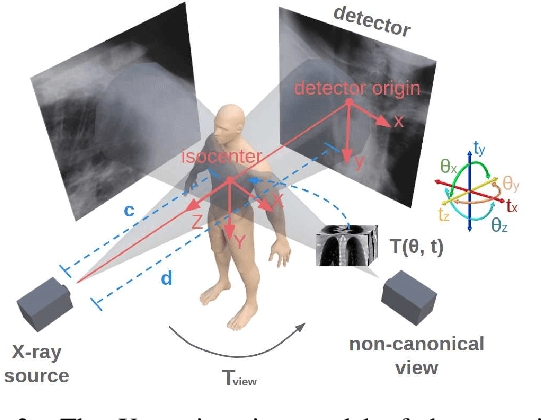 Figure 3 for Multiview 2D/3D Rigid Registration via a Point-Of-Interest Network for Tracking and Triangulation (POINT^2)