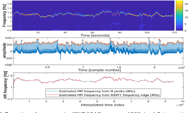 Figure 3 for Recognition of Patient Groups with Sleep Related Disorders using Bio-signal Processing and Deep Learning