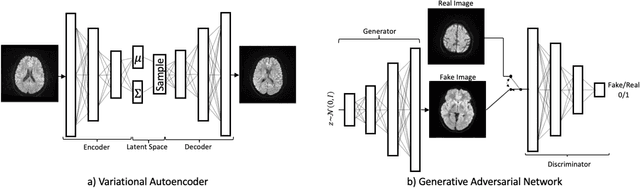 Figure 1 for Diffusion-Weighted Magnetic Resonance Brain Images Generation with Generative Adversarial Networks and Variational Autoencoders: A Comparison Study