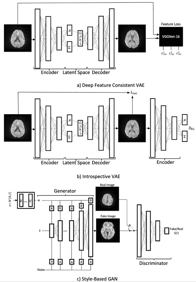 Figure 3 for Diffusion-Weighted Magnetic Resonance Brain Images Generation with Generative Adversarial Networks and Variational Autoencoders: A Comparison Study
