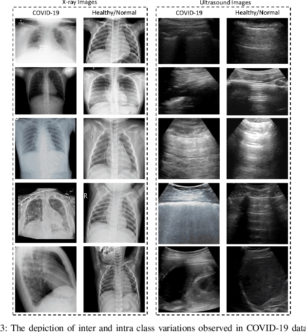 Figure 3 for Collaborative Federated Learning For Healthcare: Multi-Modal COVID-19 Diagnosis at the Edge