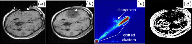 Figure 1 for Registration of Images with Outliers Using Joint Saliency Map