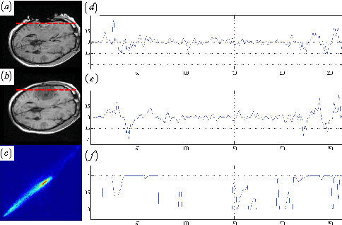 Figure 3 for Registration of Images with Outliers Using Joint Saliency Map