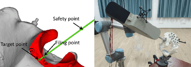 Figure 3 for A total hip surgery robot system based on intelligent positioning and optical measurement