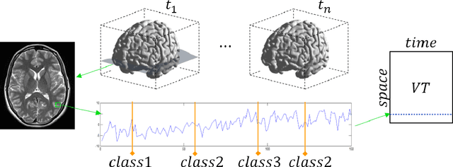Figure 1 for Learning Deep Temporal Representations for Brain Decoding