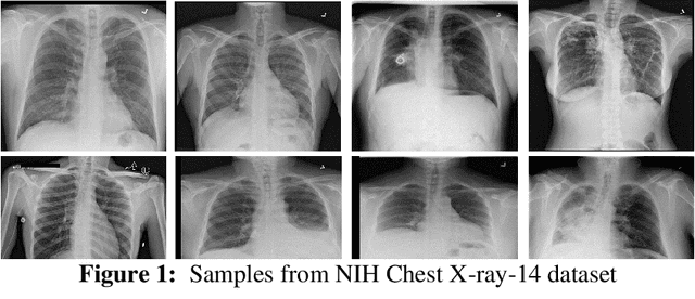 Figure 2 for Automatic Diagnosis of Pneumothorax from Chest Radiographs: A Systematic Literature Review