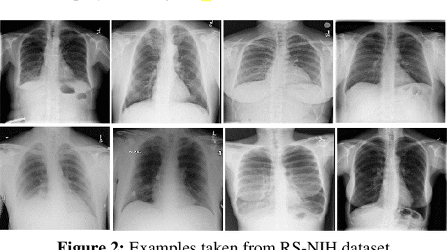 Figure 3 for Automatic Diagnosis of Pneumothorax from Chest Radiographs: A Systematic Literature Review
