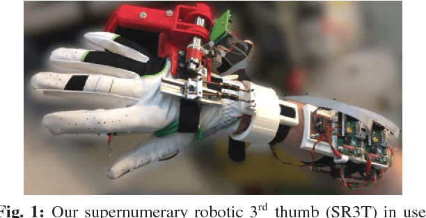 Figure 1 for The Supernumerary Robotic 3rd Thumb for Skilled Music Tasks