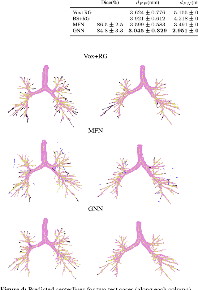 Figure 4 for Graph Refinement based Tree Extraction using Mean-Field Networks and Graph Neural Networks