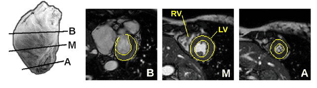Figure 1 for Convolutional module for heart localization and segmentation in MRI