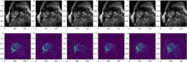 Figure 2 for Convolutional module for heart localization and segmentation in MRI