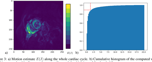 Figure 4 for Convolutional module for heart localization and segmentation in MRI