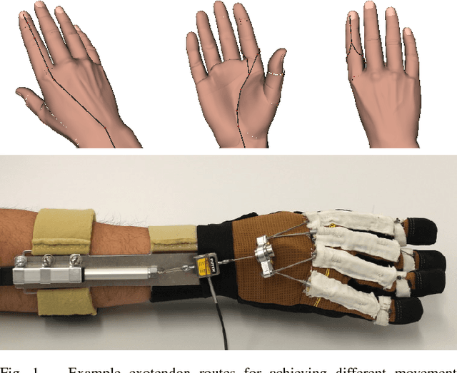 Figure 1 for On the Feasibility of Wearable Exotendon Networks for Whole-Hand Movement Patterns in Stroke Patients