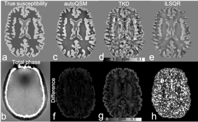 Figure 4 for Learning-based Single-step Quantitative Susceptibility Mapping Reconstruction Without Brain Extraction