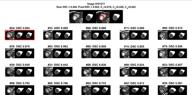 Figure 3 for Automated Quality Control in Image Segmentation: Application to the UK Biobank Cardiac MR Imaging Study