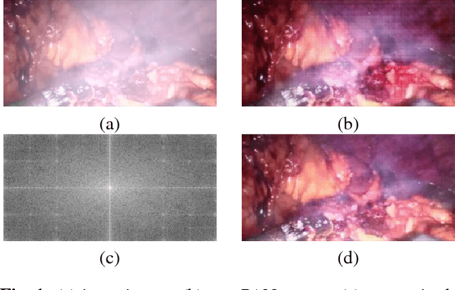 Figure 1 for Generative Smoke Removal