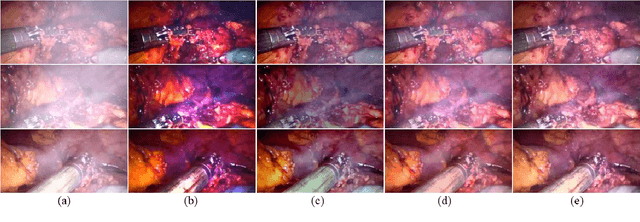 Figure 4 for Generative Smoke Removal