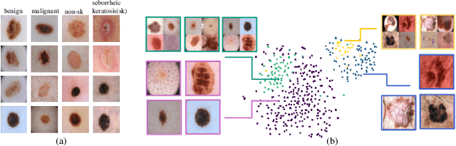 Figure 3 for An Active Learning Approach for Reducing Annotation Cost in Skin Lesion Analysis