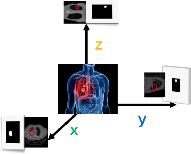 Figure 4 for Efficient Lung Cancer Image Classification and Segmentation Algorithm Based on Improved Swin Transformer